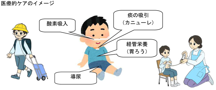 医療的ケアのイメージ