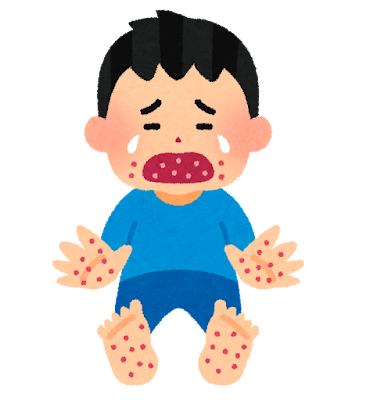 手足口病